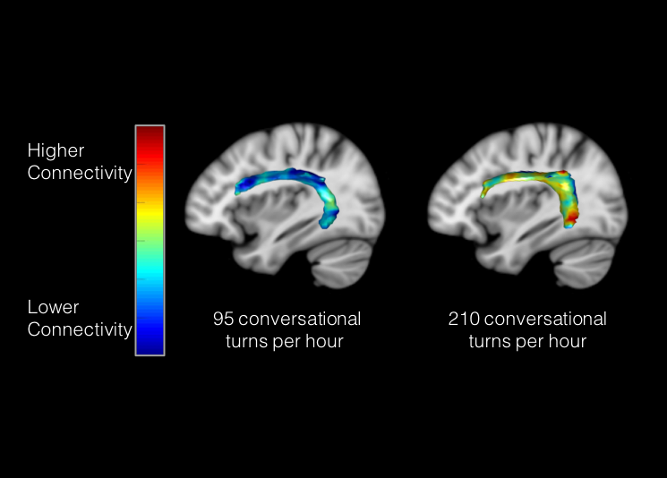Neuroanatomical connectivity associated with adult-child conversational turns