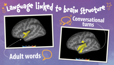 Language linked to brain structure