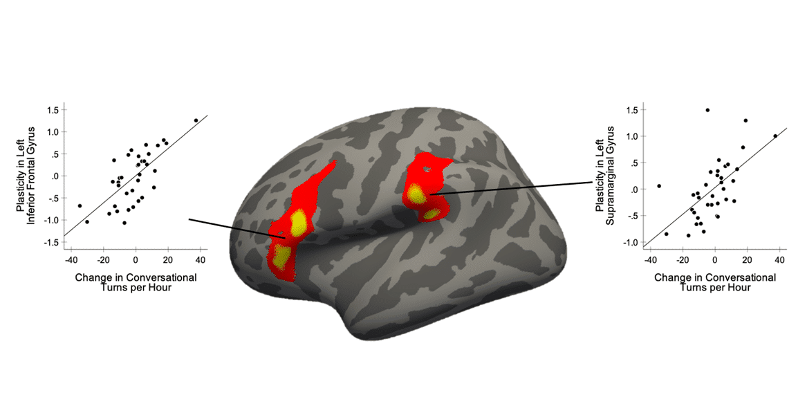 MRI image of a brain