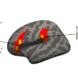 MRI image of a brain