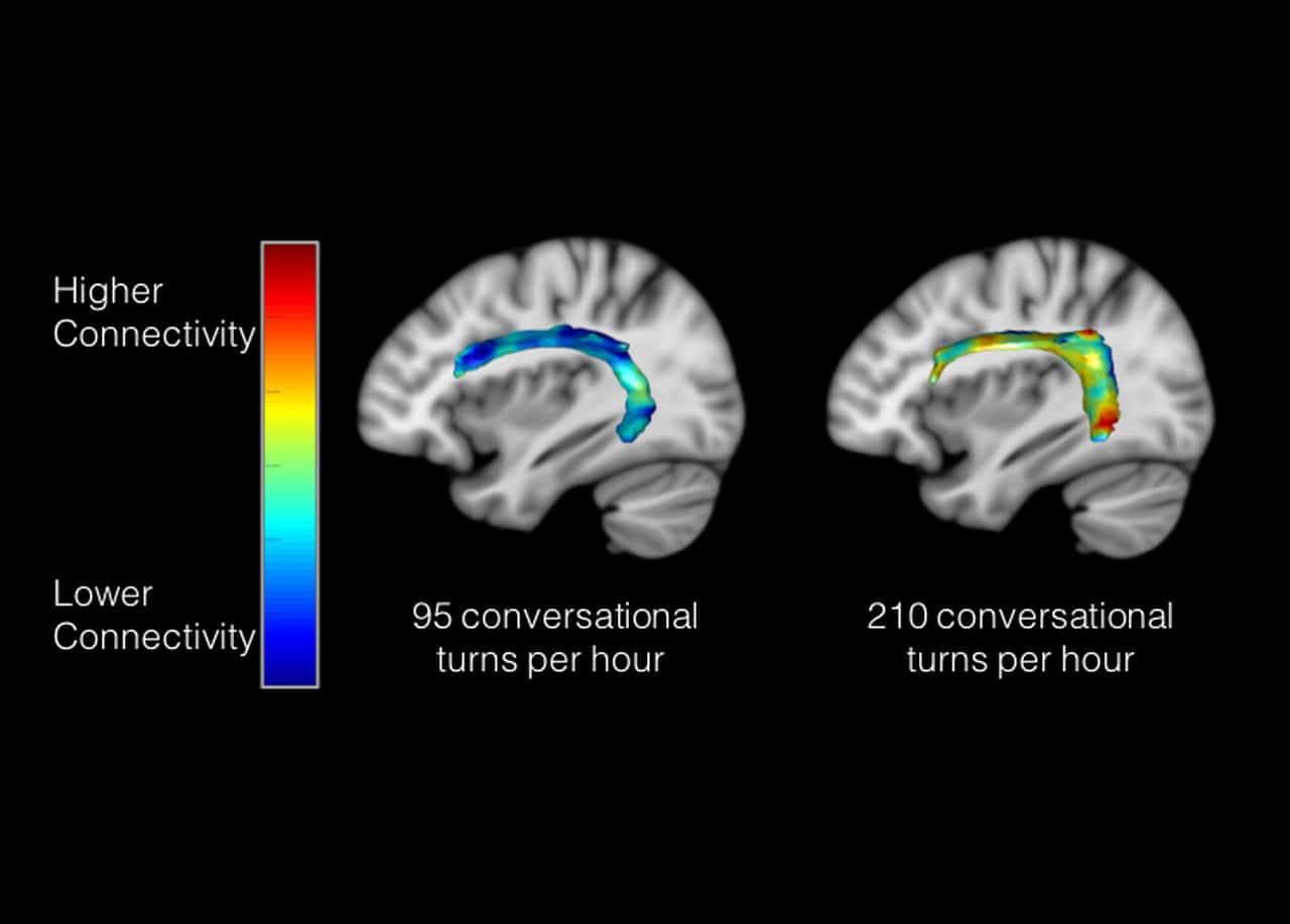 Two brain scans show neural connectivity in children with different amounts of conversational turns per hour, using a color scale from blue (lower connectivity) to red (higher connectivity).